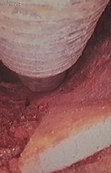 Thompson Trenchless and Hydro Jetting found bread and build-up in a pipe during an inspection on 09-26-2024 at 10:01 am.